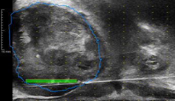 schwarz weißes Bild mit grünem und blauen Highlight.